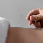 Acupuncture 50 mins